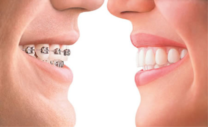 Diş Estetiği Neden Yapılmalıdır?